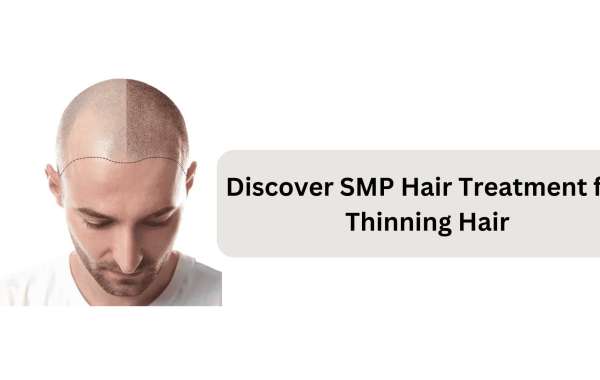 Discover SMP Hair Treatment for Thinning Hair