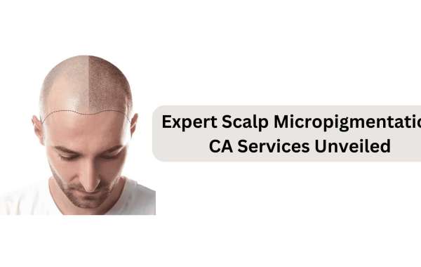 Expert Scalp Micropigmentation CA Services Unveiled