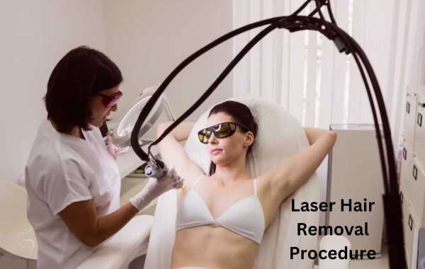 Exploring the Benefits of a Laser Hair Removal Procedure