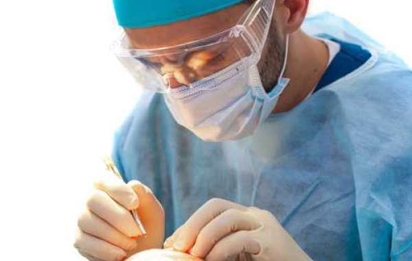 Hair Transplant in Delhi