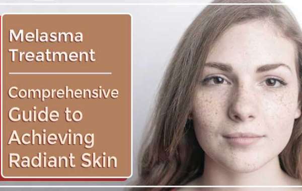 Melasma Treatment in Gurgaon — Skin Pigmentation Treatment