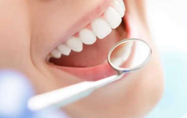 MetroPlus Dentist Near Me: Accessible Dental Care in Your Area